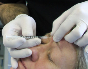 Anti-Wrinkle-Injection close up