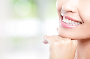 Veneers