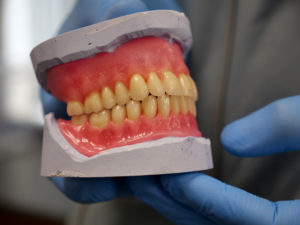 Denture replacement